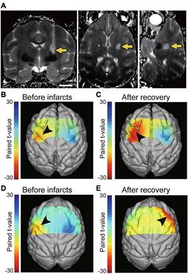 Non-human Primate Models to Explore the Adaptive Mechanisms After Stroke